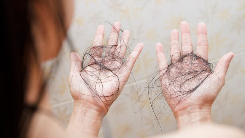 International Alopecia 2025: Cosmetic Surgeons explain why autoimmune hair loss is on the rise